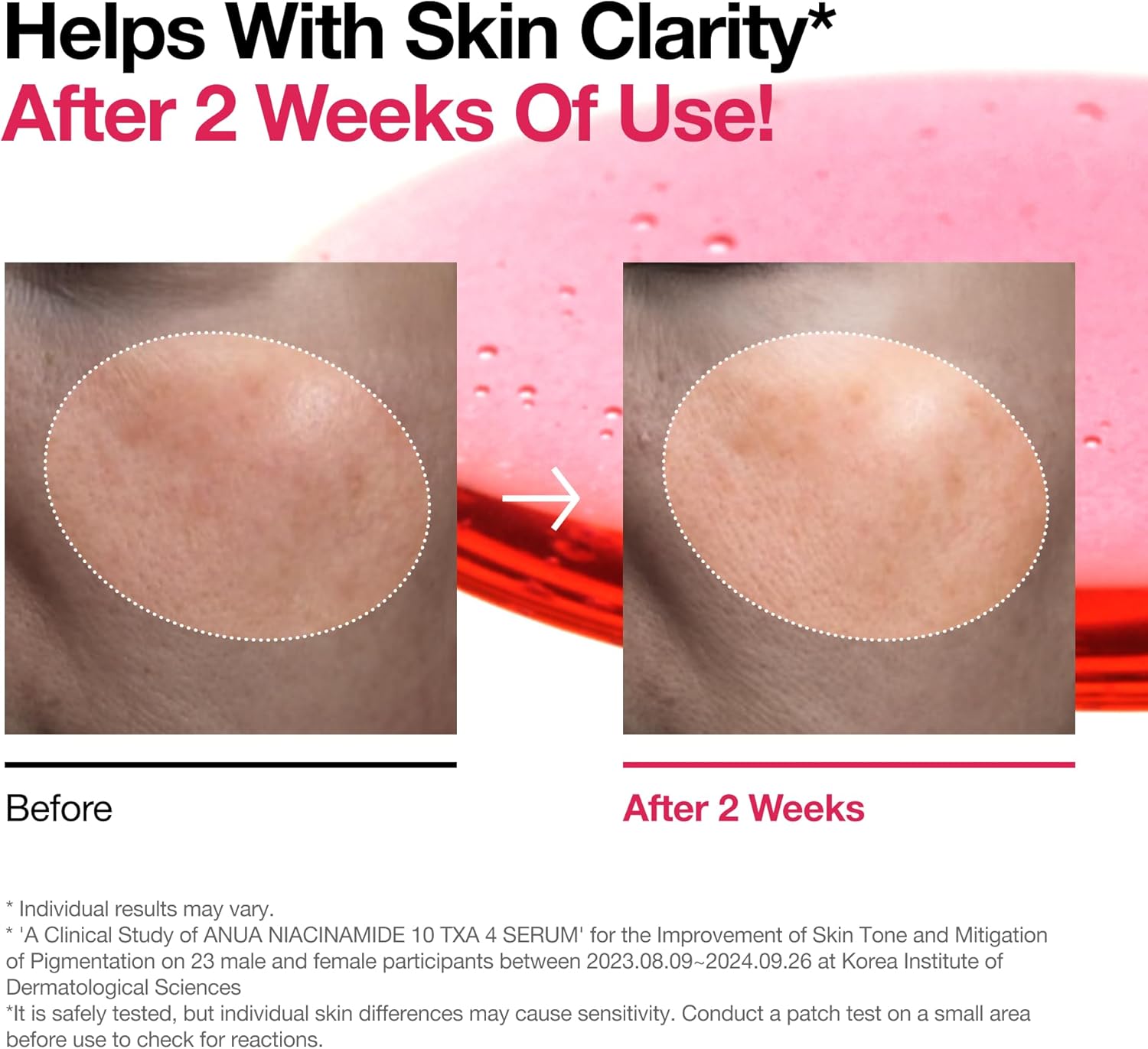 10% Niacinamide+ 4% TXA Serum, Ceramide, Hyaluronic Acid, Tranexamic Acid, Vitamin B12 Natural Color, Korean Glass Skin, Fragrance-Free, Dark Spot Serum, Korean Skincare, 30Ml /1.01 Fl.Oz.